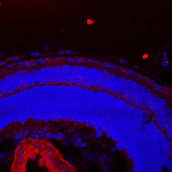 IF of P10 mouse retina labeled with DSHB antibody CPTC-CKB-1 against Creatine kinase B chain (red). Image credit: Lachke Laboratory, University of Delaware. 